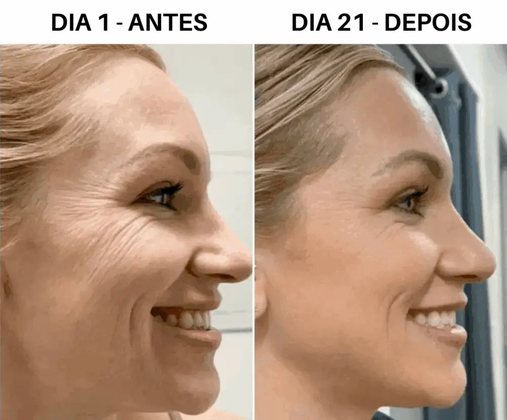 Resultado GlowLift